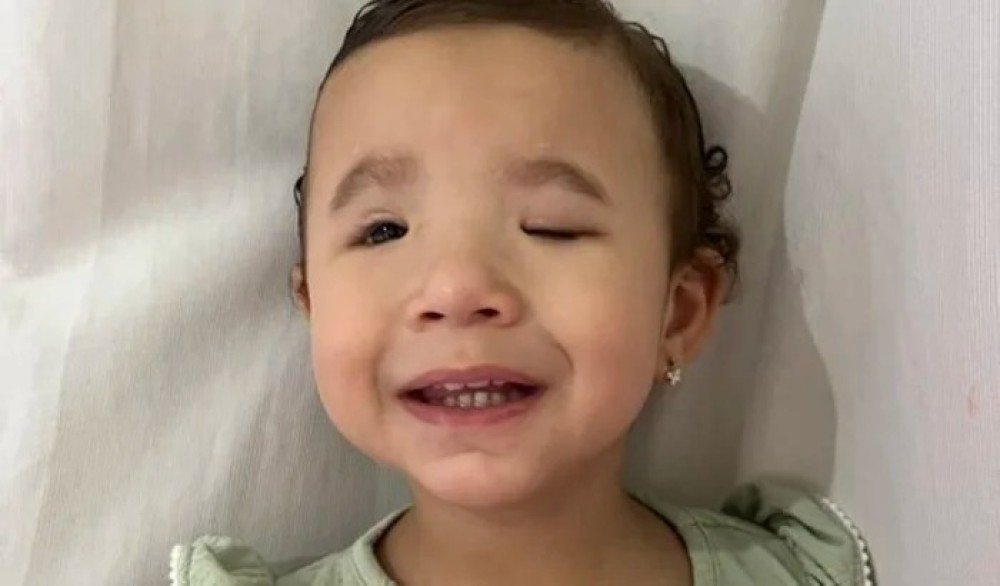 Menina de 1 ano e 10 meses precisa de cirurgia urgente para não perder a visão