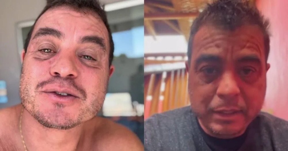 Veja como está Dhomini hoje, que chegou a voltar ao BBB e assumiu falência