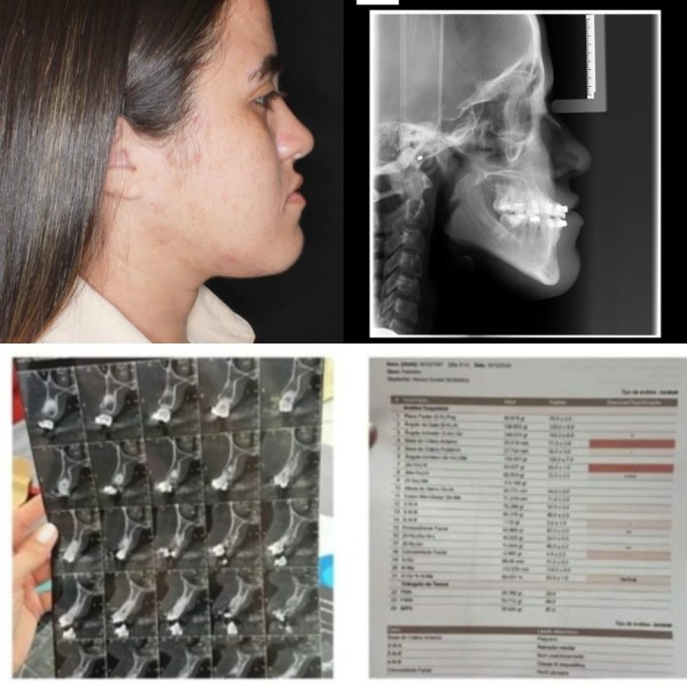 Mulher que esperava cirurgia pelo SUS descobre que nome não está na fila