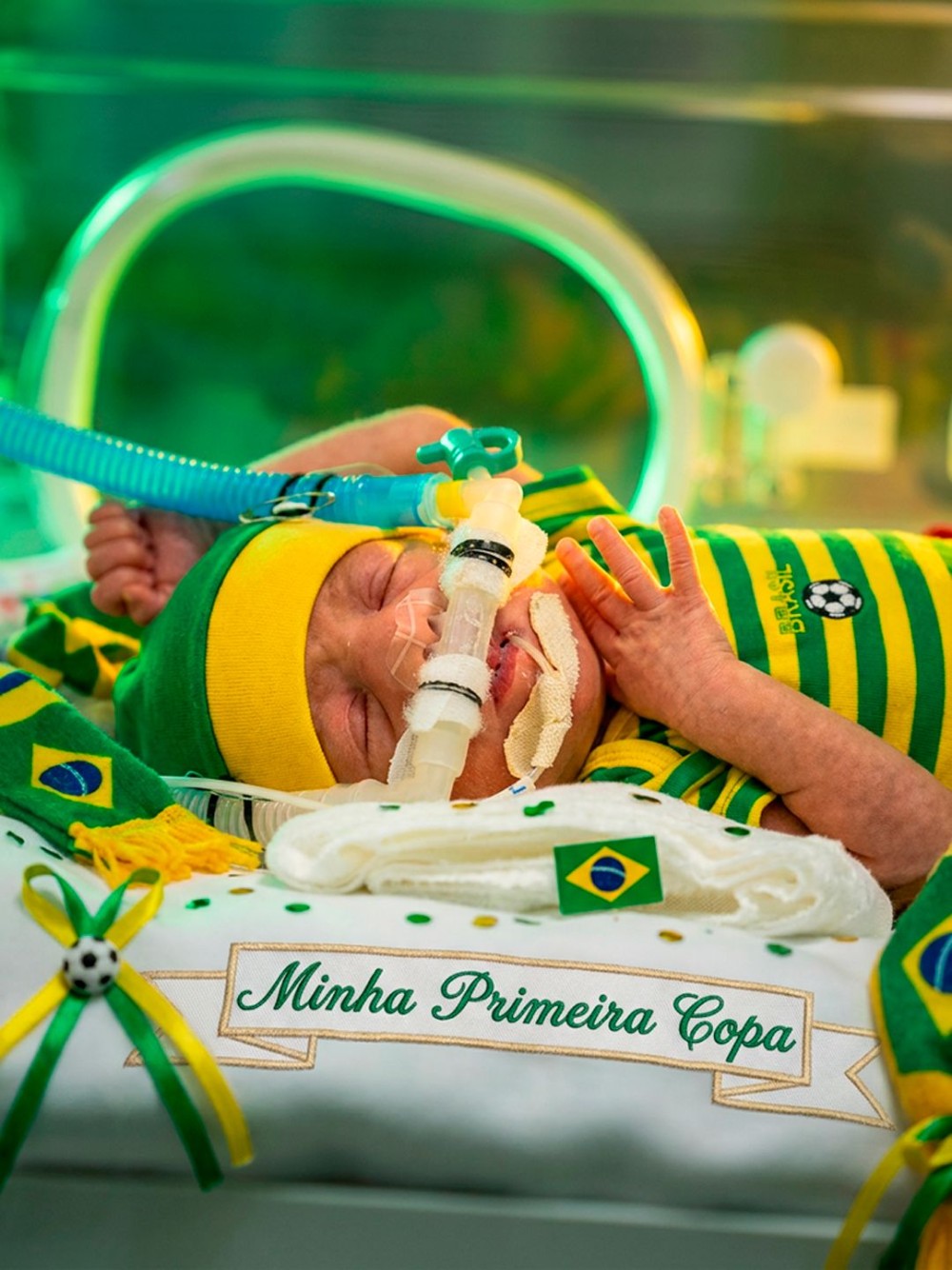 Hospital Jaraguá faz homenagem à Copa do Mundo com imagens temáticas dos pequenos pacientes da UTI Neonatal