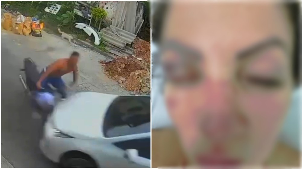 Parlamentar atropela o namorado após ser agredida (veja o vídeo)