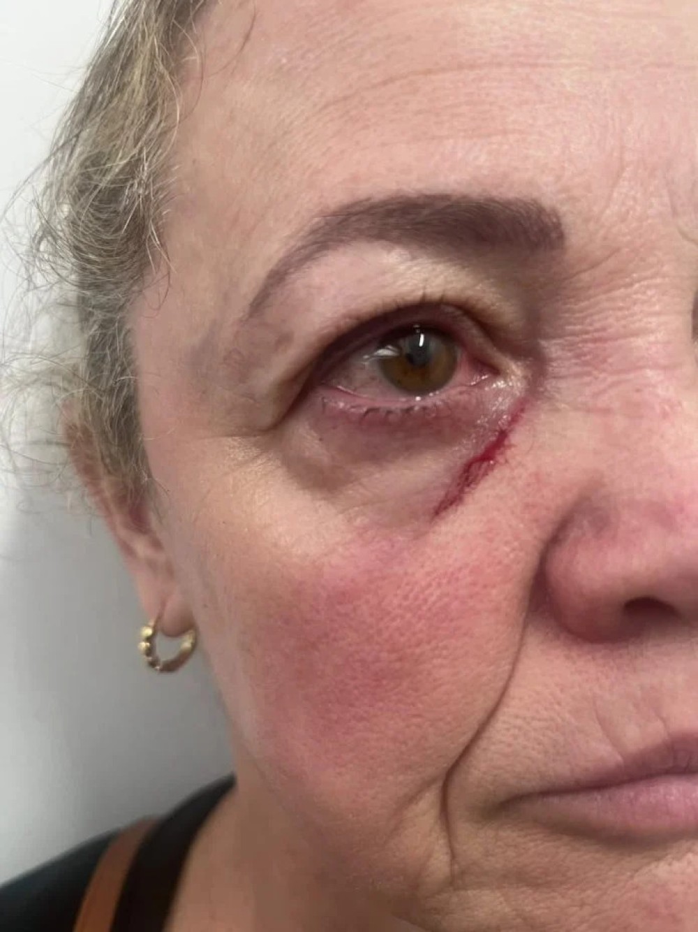 Professora é agredida por aluno em escola de SC