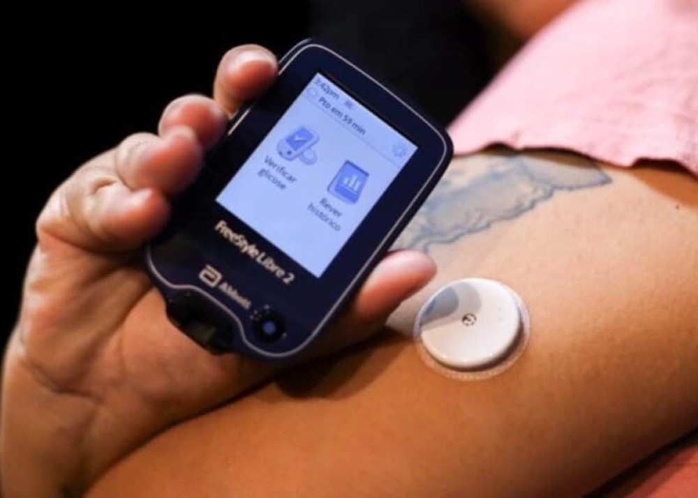 Vereadores derrubam veto ao projeto sobre sensor de glicemia