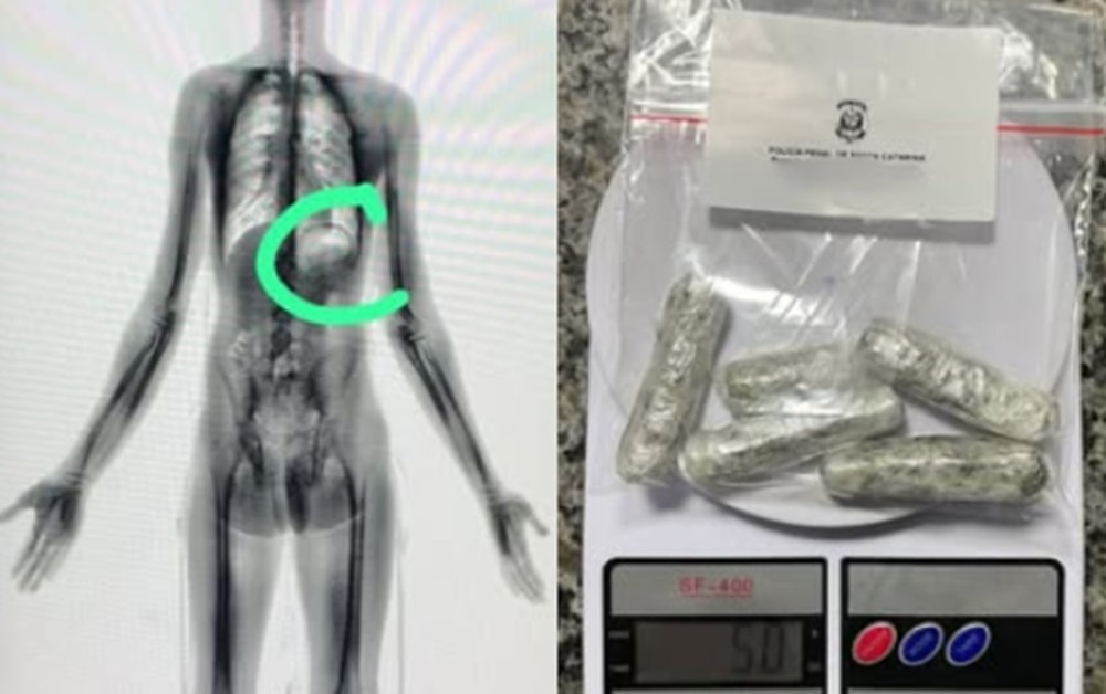 Detento é flagrado com droga no estômago em Jaraguá do Sul