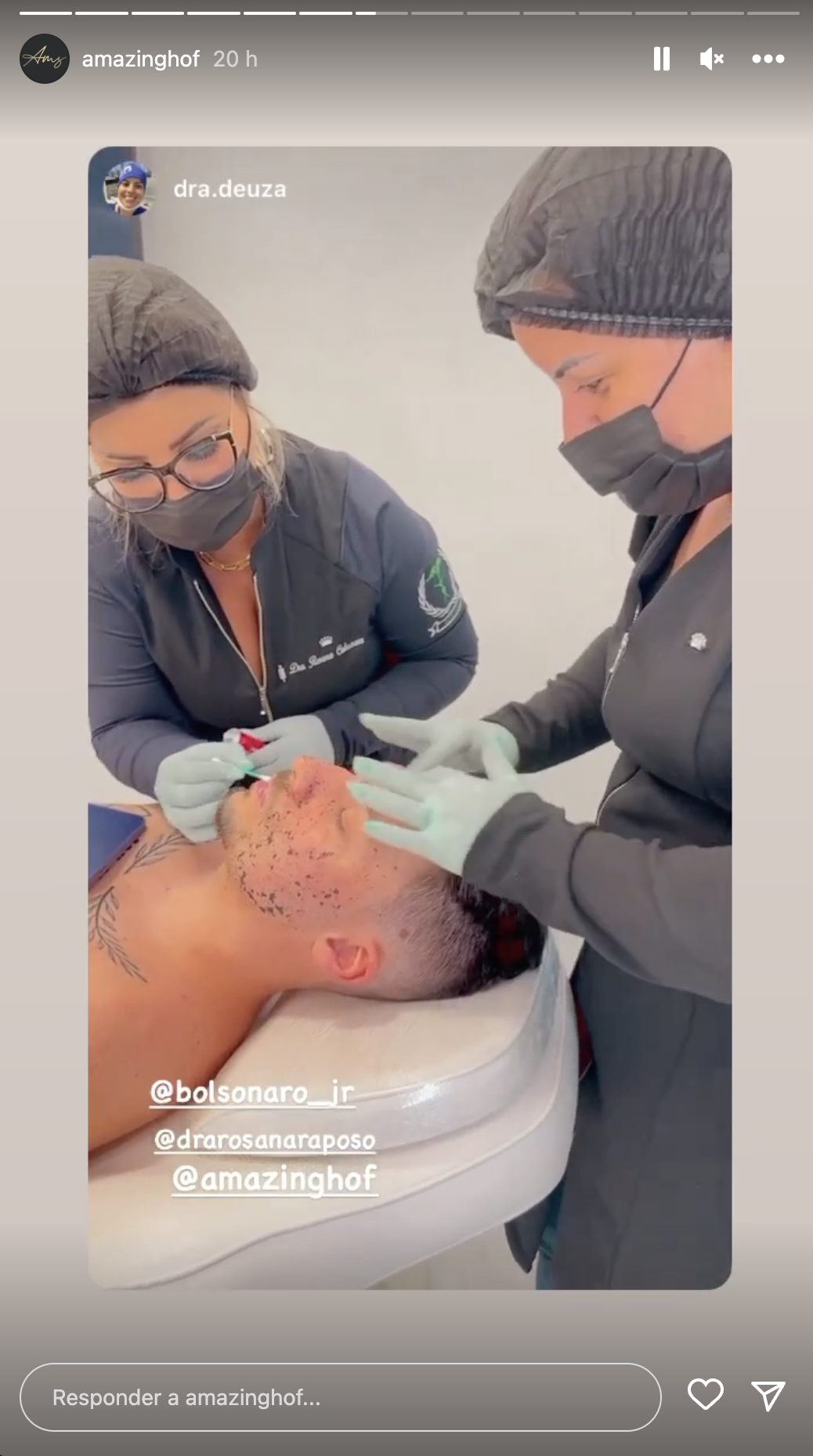 Renan Bolsonaro mostra harmonização facial e corporal