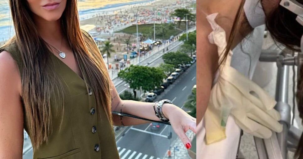 Imagens fortes expõem famosa em maca durante cirurgia para tirar tumor da cabeça: “Meu mundo caiu”